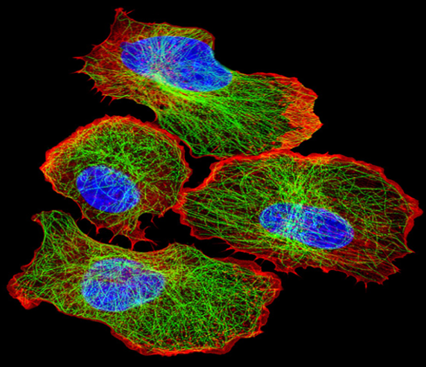 EZCell™ Cell Migration and Invasion Assays Caltag Medsystems