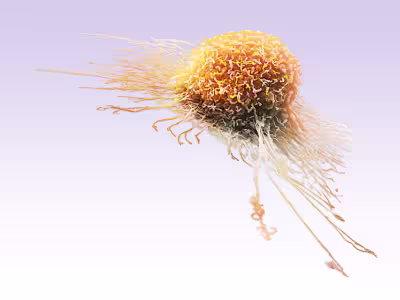 Cancer Cell