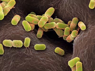 E. coli Inflammation
