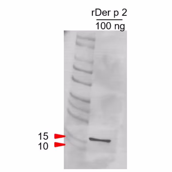 Der p 2 Western Blot