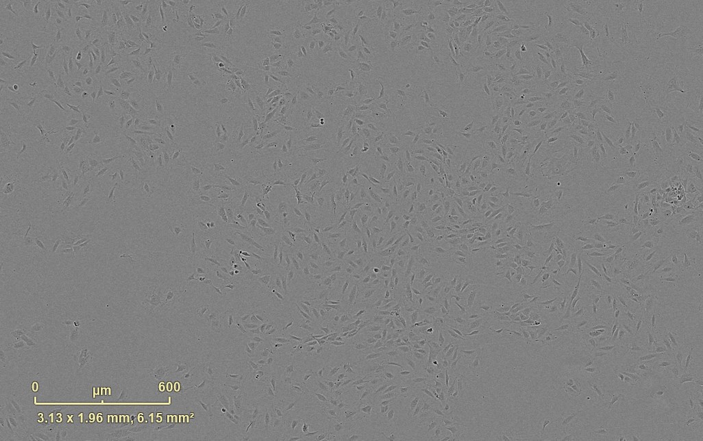 Bright field image of HUVECs, pooled donor (Cat# CCD-6000)