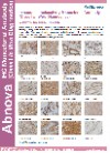 Immunohistochemistry Monoclonal Antibody (Class I In Vitro Diagnostics)