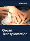 Organ Transplantation ELISAs