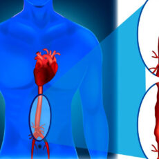 New Mechanistic Insights to Hereditary Vascular Disease