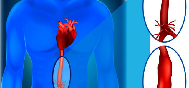 New Mechanistic Insights to Hereditary Vascular Disease