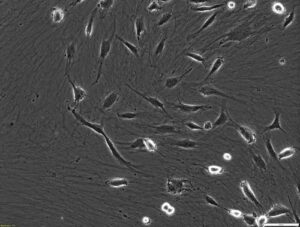CELLvo™ Cord Blood Endothelial Progenitor Cells (hCB-EPC) (100x). These are rare cells that are highly proliferative and highly angiogenic when isolated and grown on CELLvo™ Matrix.