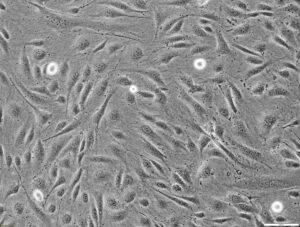 CELLvo™ Human Endothelial Progenitor Cells