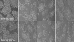 CELLvo™ Matrix Plus from StemBiosys comparison