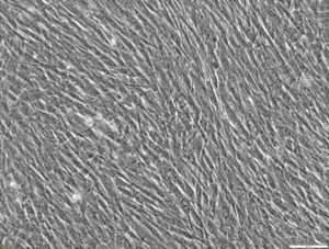 CELLvo™ Human Wharton's Jelly Mesenchymal Stem Cells