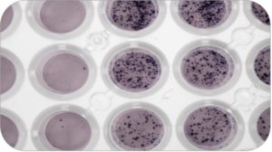 Immunoassay meets bioassay. ELISpot Image from Diaclone