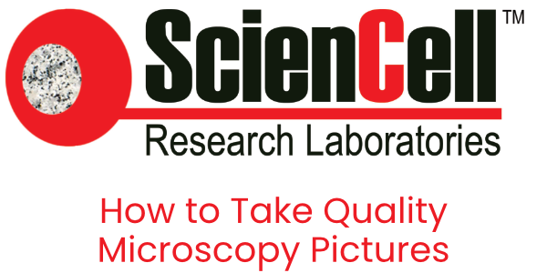 3 Techniques and 3 Tips to Take High-Quality Microscopy Pictures of Primary Cells