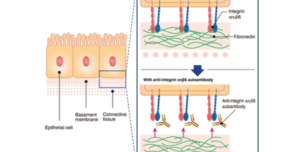 Leveraging Anti-Integrin αvβ6 Antibodies for Ulcerative Colitis