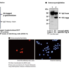 HA-tags: Better Understanding of Localisation, Expression and Purification of Target Proteins
