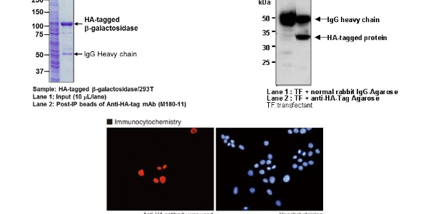 HA-tags: Better Understanding of Localisation, Expression and Purification of Target Proteins