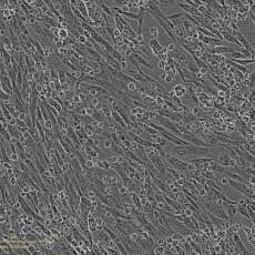 Webinar on iPSC-Cardiomyocytes & Human Cell-Derived Extracellular Matrix – 28th September