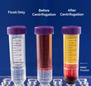 Peripheral Blood Mononuclear Cells: A Brief Review – Caltag Medsystems