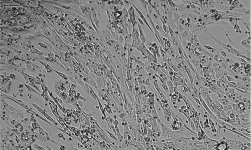 IPSC- derived Cardiomyocytes