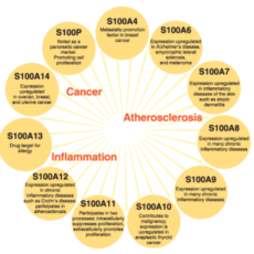 S100 Proteins Regulate Metabolic and Immune Pathways to Influence Disease State