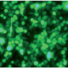 Airway Epithelial Cells: Coronaviruses’ gateway to infection