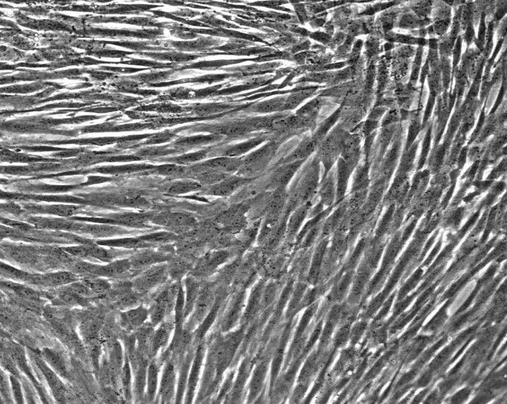 CELLvo™ Human Wharton's Jelly Mesenchymal Stem Cells
>1,000,000 cryopreserved cells (Passage 2)