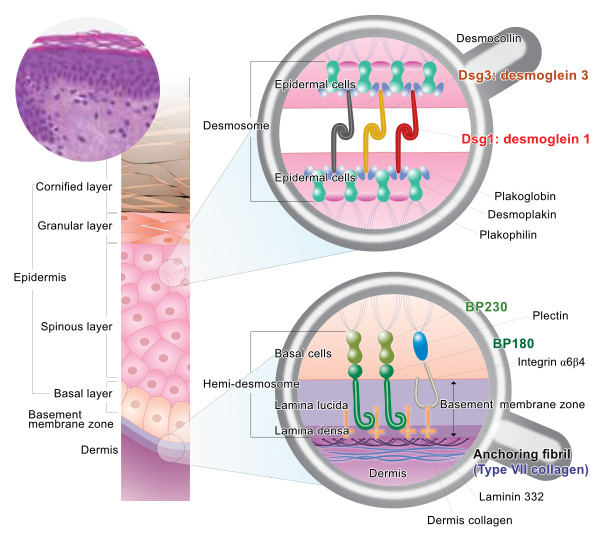 Autoimmune Blistering Diseases
