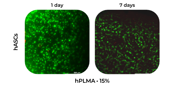 Cell Encapsulation in Hydrogels cells