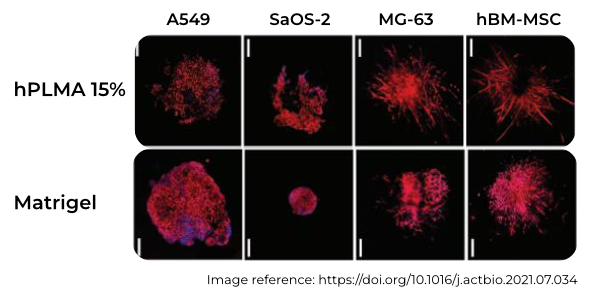 Cell invasion and proliferation cells