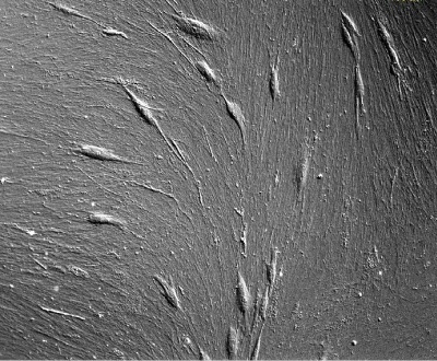 High resolution bright-field image of cells on CELLvo™ Matrix