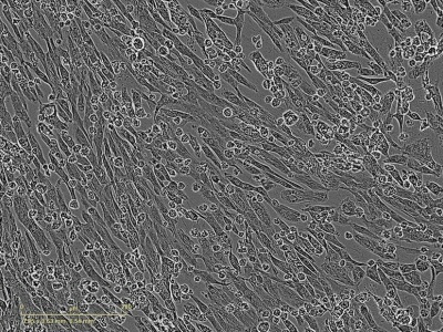 iPSC-derived cardiomyocytes spontaneously align and structurally mature when seeded on CELLvo™ Matrix Plus