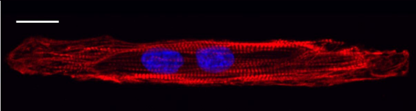 iPSC-derived cardiomyocytes become binucleated during culture on CELLvo™ Matrix Plus