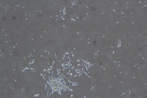 Tissue Culture Plastic
